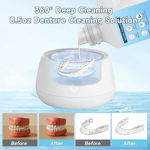 Ultrasonic Retainer Cleaner Solution for Ultrasonic Denture Cleaner-Professional Cleaning of Retainers, Invisible Aligners, Mouth Guards, Night Guards, Remove Odors, Discoloration & Stains 32oz