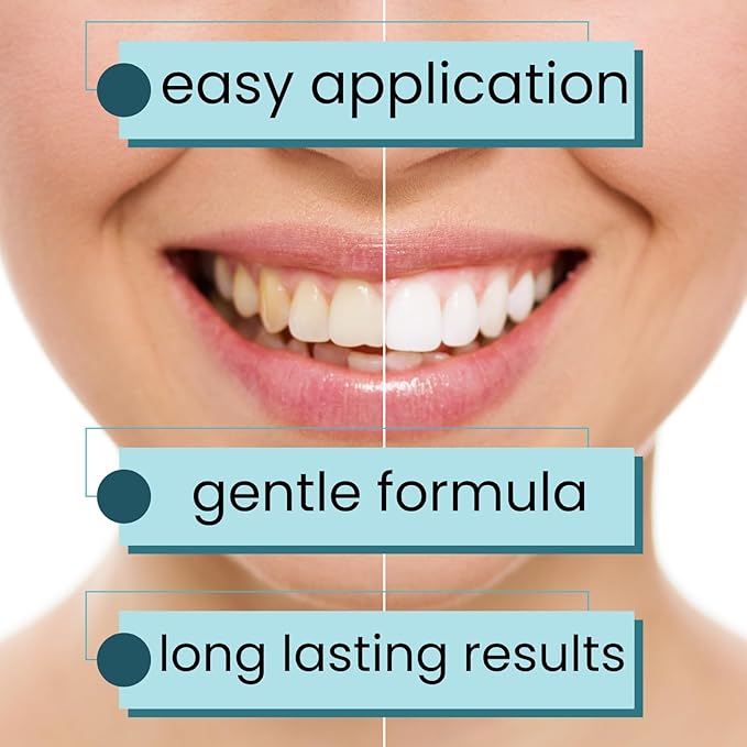 Natural Teeth Whitening Strips – Enamel Safe Gentle Whitening for Sensitive Teeth, Vegan-Friendly White Strips Without Peroxide or Bleach, 14-Day Treatment with 28 Count Supply