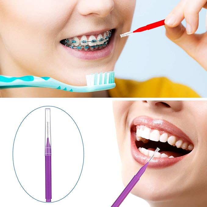 Patelai 100 Pieces Braces Brush for Cleaner Interdental Brush Toothpick Dental Tooth Flossing Head Oral Dental Hygiene Flosser Toothpick Cleaners Tooth Cleaning Tool(Warm Colors,Various Sizes)