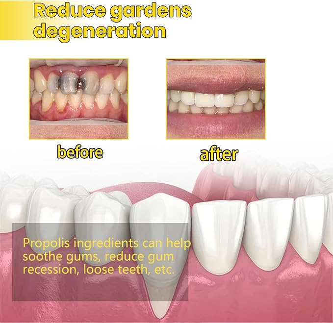 Propolis Gum Care Gel with Allantoin, Arginine and Calendula Extract, Soothing Oral Care Formula for Gingival Comfort and Mouth Health, Natural Ingredients, 4ml