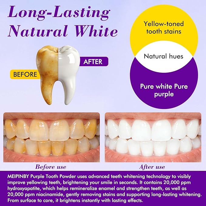 2 PCS Teeth Whitening Powder, Hydroxyapatite Remineralizing Tooth Powder with Niacinamide,R5X Advanced Purple Color Balance Immediate Results, Mint Flavor, 2 * 50 Grams