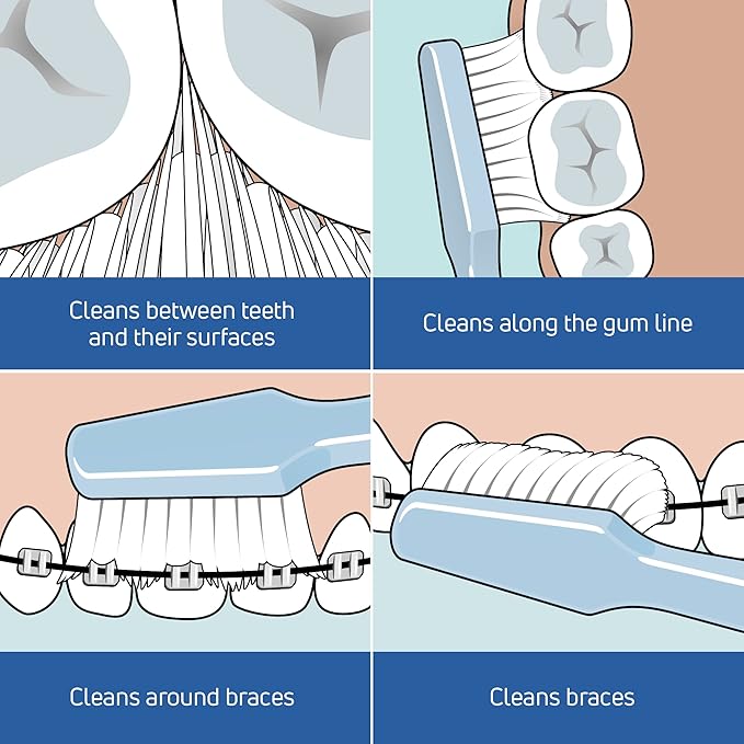TePe Select Medium Toothbrush, Adult Medium-Bristle Toothbrush with Compact Tapered Head and Angled Neck, Pack of 1