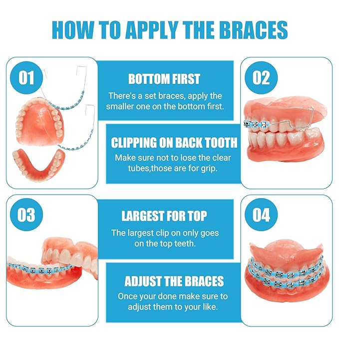 4 Pair of Temporary Tooth Decoration, Teeth Retainer Practical Brackets para Dientes Sturdy Retenedores de Dientes Ortodoncia Props for Dental Students to Practice (Blue)