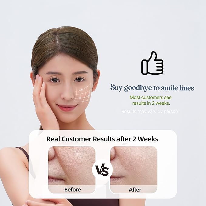 Smile Line Patches (12 pcs), Nasolabial Folds & Laugh Line Patches, Mouth Wrinkle Mask & Smoothing Patches, Smile Wrinkle Patch & Anti-Wrinkle for Face, Collagen Strip Facial Stickers