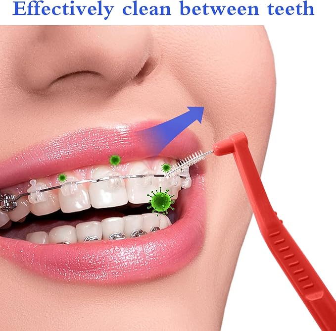 Angzhili 25 Pcs Interdental Angle Brushes,Reusable Dental Cleaners,Oral Dental Hygiene Brush,Dental Toothpick Floss for Braces,Tooth Cleaning Tool (Red)