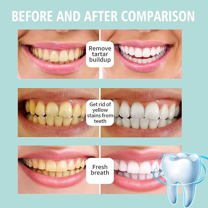 Teeth Total Care Mouthwash, Ultra-Fine Herbal Foam, Mint Taste, Repairs Sensitive Teeth, Refreshes Breath, Cleans Deeply, Solves Oral Problems (3pc)