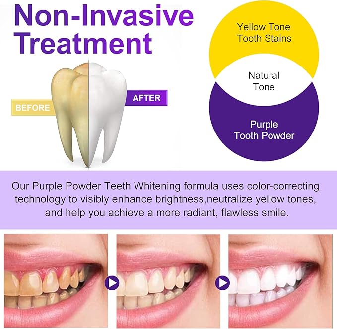 Teeth Whitening Powder - Teeth Whitening - Removes Stains - No Sensitivity - Enamel-Safe Toothpaste Power - Breath Freshener - for Coffee, Tea and Tobacco Stains 15g