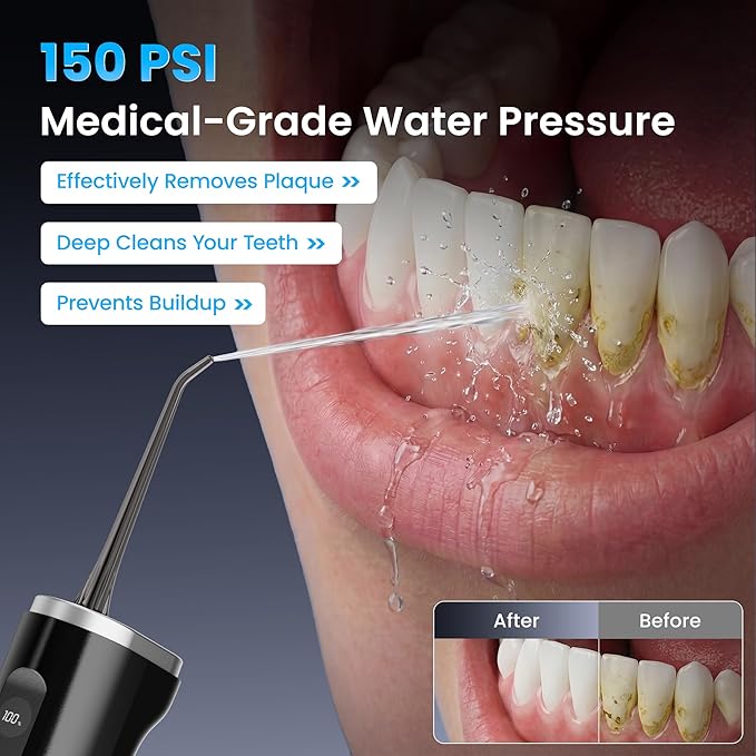 Water Flosser Cordless, 100-Modes Portable Dental Floss Water Picks, 150-Psi High Pressure for Teeth Cleaning and Flossing, 300ML & IPX7 Electric Floss for Braces Kids Travel Home Black