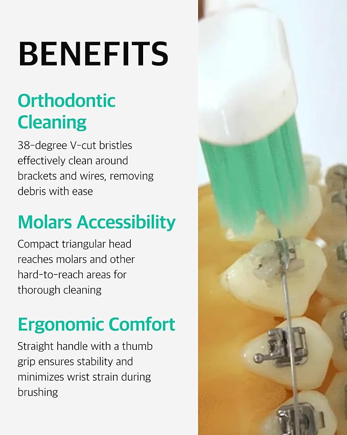 V-Cut Orthodontic Toothbrush(Mint, White) - Compact Head for Braces, Ergonomic Handle, Deep Cleaning, Gentle Bristles for Brackets and Wires