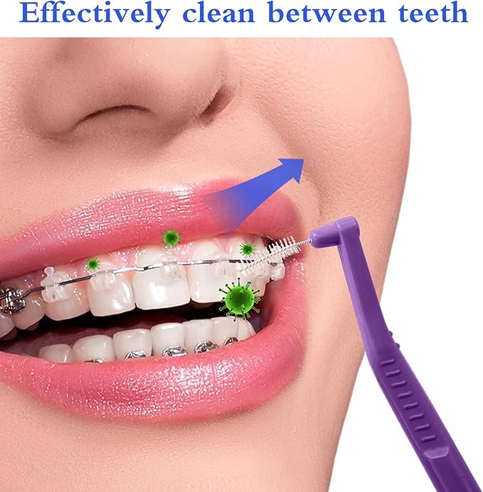 Angzhili 25 Pcs Interdental Angle Brushes, Reusable Dental Cleaners, Oral Hygiene Brush, Toothpick Floss for Braces, Tooth Cleaning Tool (Multi-Colored)