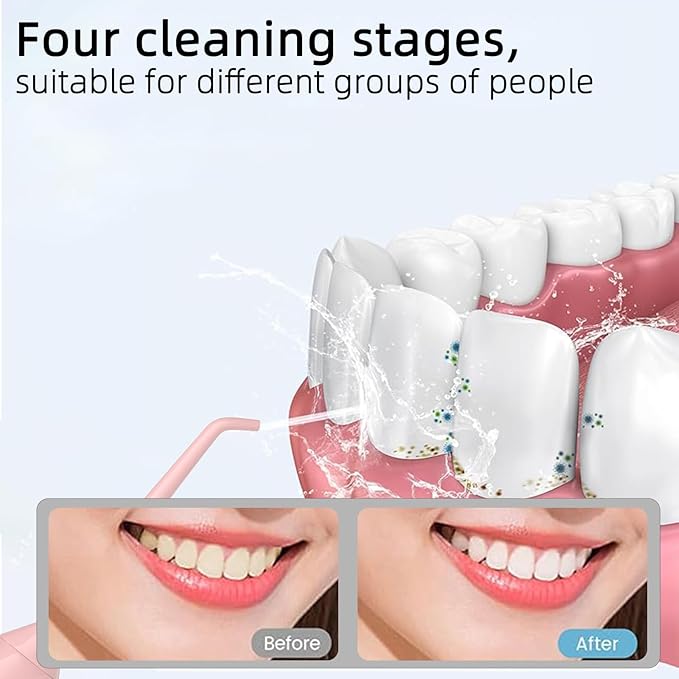 Water Dental Flosser Teeth Pick: Portable Cordless Oral Irrigator 320ML Rechargeable Travel Irrigation Cleaner with 5 Flossing Tips, IPX7 Waterproof Electric Flossing Machine for Teeth Cleaning