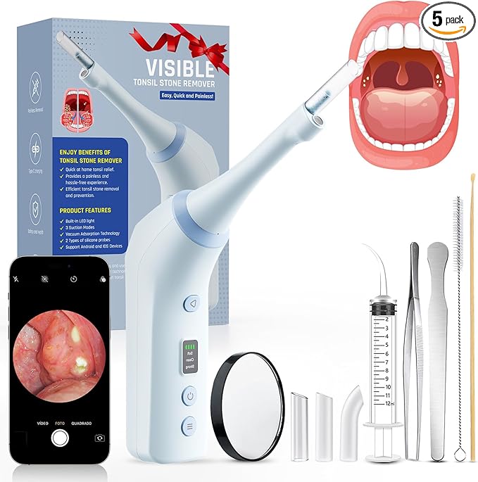 Electronic Tonsil Stone Remover with Camera, Tonsil Stone Removal Kit, 3 Suction Levels, Tonsil Stone Vacuum, Oral Care for Mouth Health, USB Rechargeable(Blue)