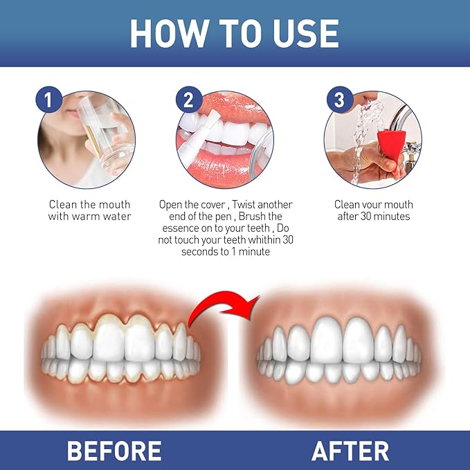 Gum Instant Soothing Gel for Gum Care, Teeth Whitening, Plaque Removal, 4ml, 0.14fl oz