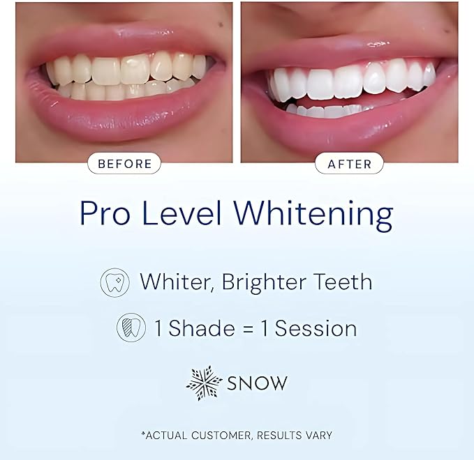 Snow Teeth Whitening Kit - Snow Teeth Whitening Serum and LED Mouthpiece Whitener, Formulated with Hydroxyapatite, Good for 2 Months - Wireless Kit with 1 Wand