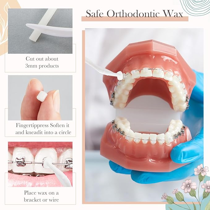 Geiserailie 5 Pack Braces Wax for Teeth New Flavored Dental Orthodontic Wax with Applicator Scraper for Braces Wearer, Oral Appliances, Aligners Patients,5 Fruit Flavors