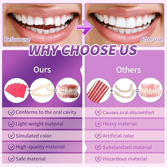 At-Home DIY Denture Kit: Full Set of Upper & Lower False Teeth for DIY Smile Transformation-A03