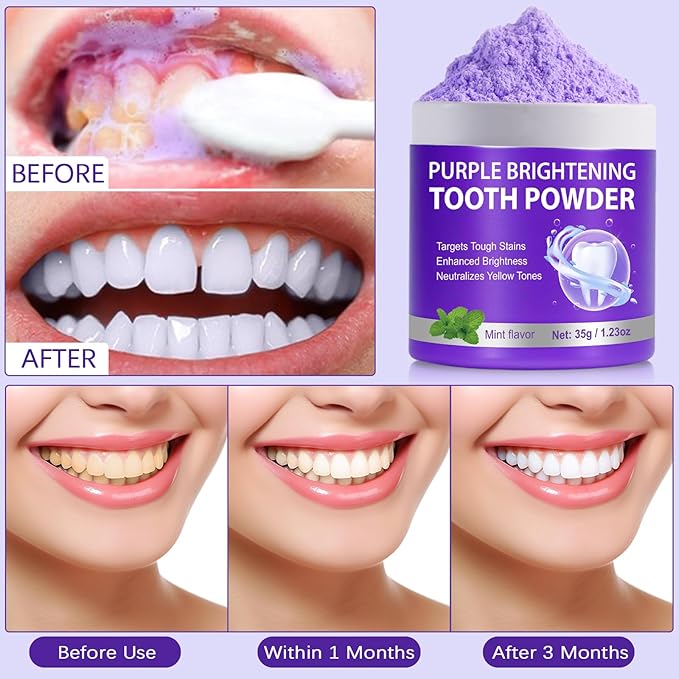 Teeth Whitening Powder, 35g Purple Teeth Whitening Powder, Effectively Lifts Stains, Strengthening Teeth and Gums, Fresh Mint Flavor, Breath Freshener