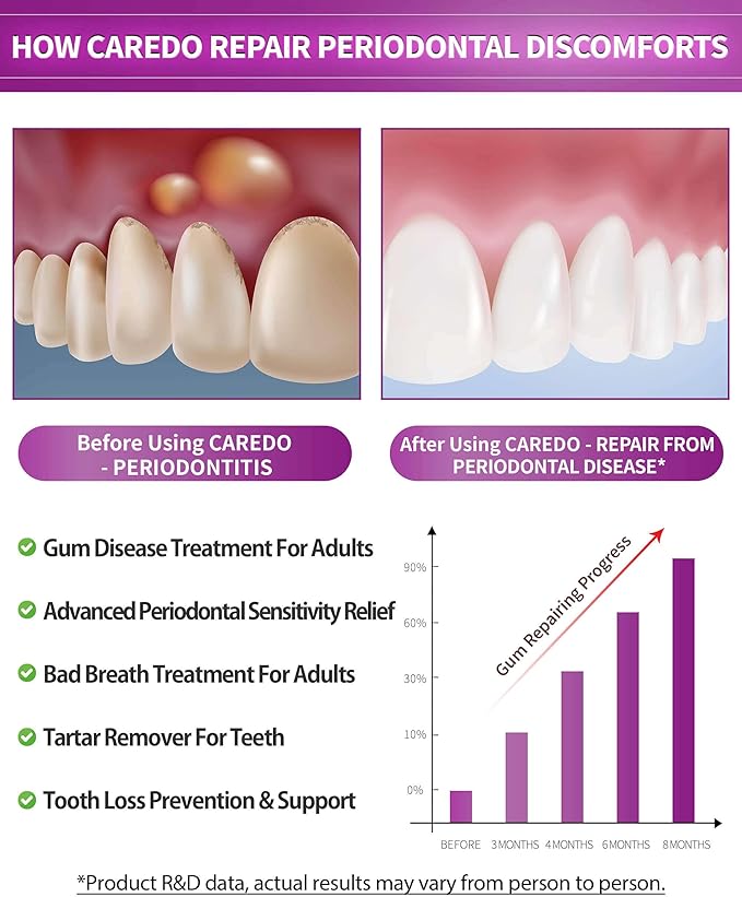 Gum Toothpaste for Periodontitis, Gum Repair for Receding Gums, Gum Disease & Gingivitis Treatment, Periodontal Disease Treatment for Gum Health, Gum Disease Repair Bad Breath Toothpaste 3.52OZ