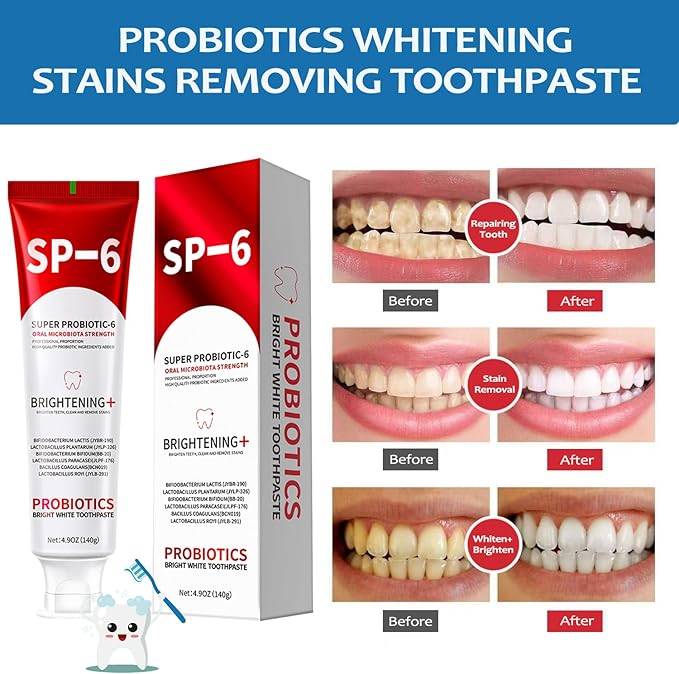 SP-6 Probiotics Whitening Toothpaste, 3 PCS 6 Probiotics Enhanced Formula Brightening Toothpastes for Teeth Whitening and Gum Health, Fluoride-Free, Fresh Breath with Mint Flavor (3 PCS)