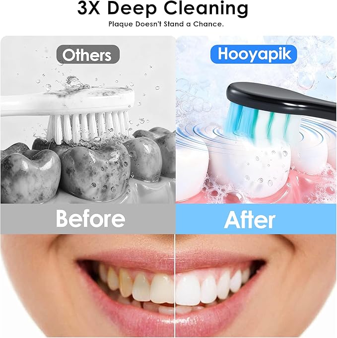 Hooyapik 38000 VPM Sonic Electric Toothbrush Set with 6 Brush Heads-2 Minute Timer-4 Cleaning Settings，IPX7 Waterproof,Lightweight and USB Rechargeable Toothbrush for Oral Care (Black)