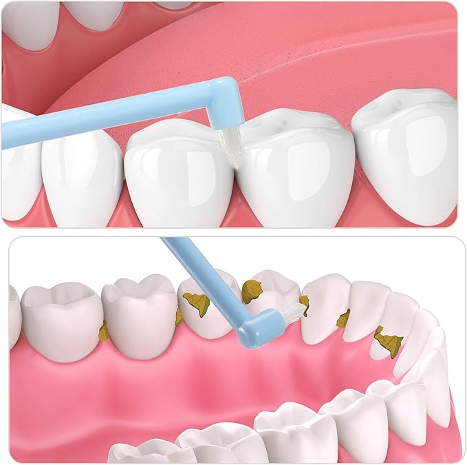 Patelai 6 Pieces End Tuft Toothbrush Single Tufted Toothbrush Soft Interdental Brushes Tooth Stain Remover for Implants Teeth Detail Cleaning Tooth Stain (Bright Colors)