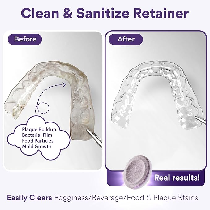 Weiss Naturals Retainer Cleaner Tablets, Invisalign Cleaner, Remove Stains, Odors & Plaque, PERSULFATE FREE Night Guard & Denture Cleaner 1-Month Supply, 30 Grape Scented Tablets