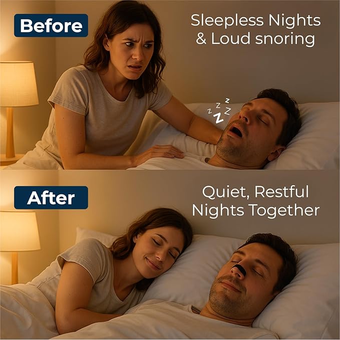 TapeGeeks Nasal Strips for Snoring Relief – Hypoallergenic Nose Strips for Breathing – Strong Hold, Gentle on Skin, Latex-Free, 30 Count