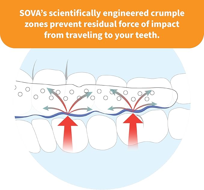 SOVA Junior Night Guard, Spring Green - 1.6mm Thin - Custom-Molded Fit - Protects Against Nighttime Teeth Grinding & Clenching - Odor & Taste Free - Remoldable Up to 20 Times