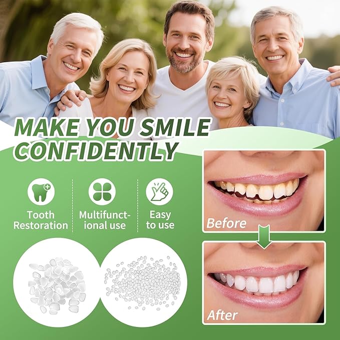 Tooth Repair kit for Filling The Missing Broken Tooth and Gaps-Moldable Fake Teeth and Thermal Beads Replacement Kit-White-A05