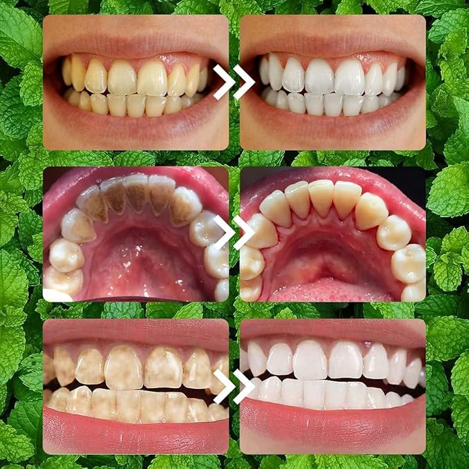 2 Pcs Teeth Restoration Mineral Powder Mineral whitening for Freshen Breath Whitening Natural Teethrestoration Powder Effective in Strengthening and Gums