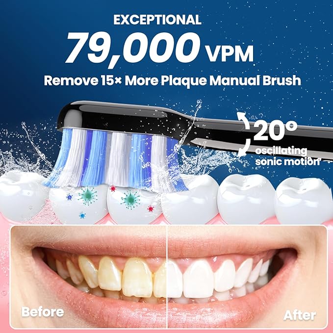 Electric Toothbrush, Sonic Toothbrush for Adults Teens with Pressure Sensor, AI Zone Cleaning Tracking, 5 Modes & 3 Intensities, 180 Days Battery Life, 4 Brush Heads with Travel Case, Black