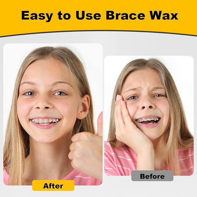 180PCS Braces Wax,Orthodontic Wax with Individual Packaging,Dental Waxs for Brace Travel Home Office,Mint and Strawberry Mix