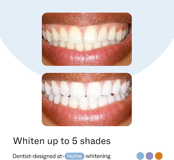 Opalescence GO Home Advanced Teeth Whitening Trays 10% (10 Treatments) Hydrogen Peroxide PF Whitening Prefilled Kit - Developed by Leaders in Professional Whitening - 5821-T