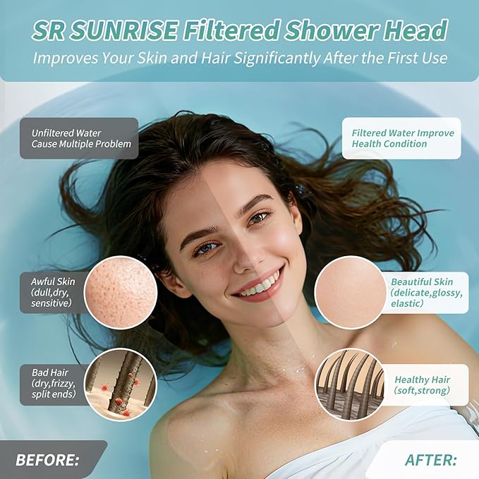 SR SUN RISE Luxury Filtered Shower Head Set, 20+3 Stage Shower Filter for Hard Water, High Output Showerhead with 3 Replaceable Filter Cartridges Removes Chlorine and Fluoride, Chrome