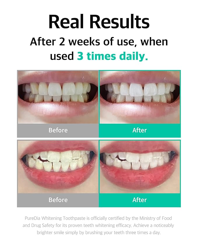 Whitening Toothpaste 80g x 3 – Fluoride-Free, Nano Hydroxyapatite & Hydrogen Peroxide, Sensitive Teeth, Enamel Strengthening, Natural Mint Gel