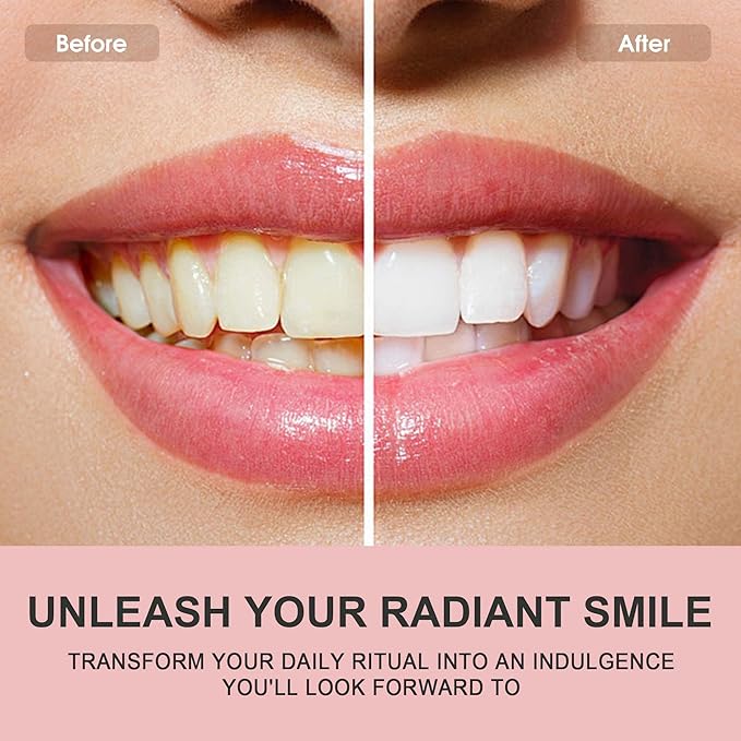 Hotluck Niacinamide Whitening Toothpaste - Brightening, Stain Removal, Freshening Breath - Deep Gentle Cleaning Tooth Paste, Boosting Gum Health, Mint & Peach 3.53oz (Pack of 3)