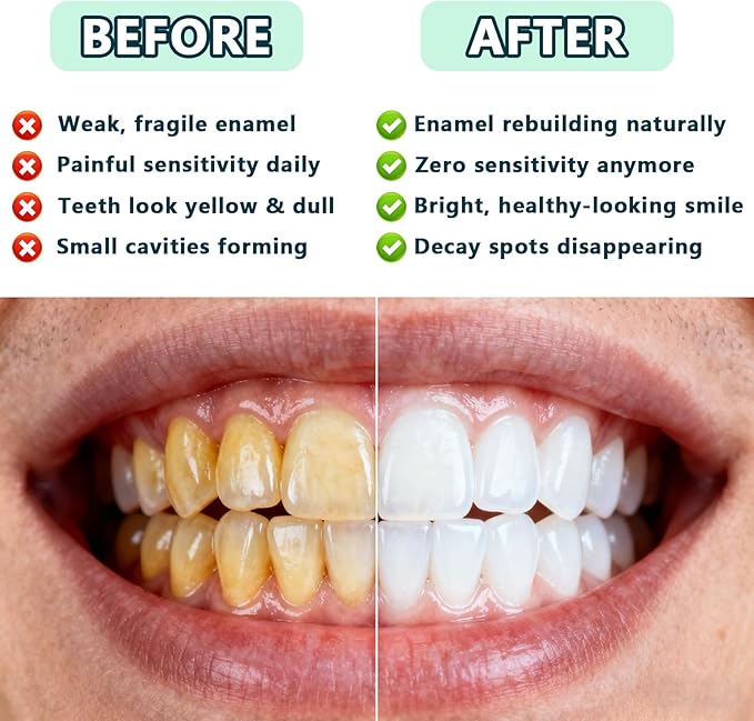 Nano Natural Probiotic Hydroxyapatite Toothpaste - Mild Mint | Fluoride-Free, Remineralizes Teeth, Freshens Breath, Suitable for Sensitive Teeth, Daily Oral Care (2pcs)