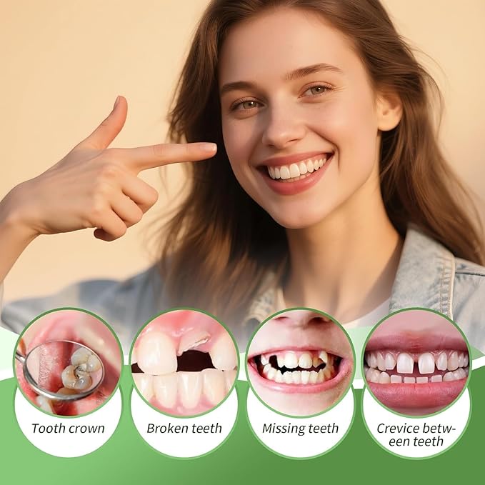 Tooth Repair kit for Filling The Missing Broken Tooth and Gaps-Moldable Fake Teeth and Thermal Beads Replacement Kit-White-A05