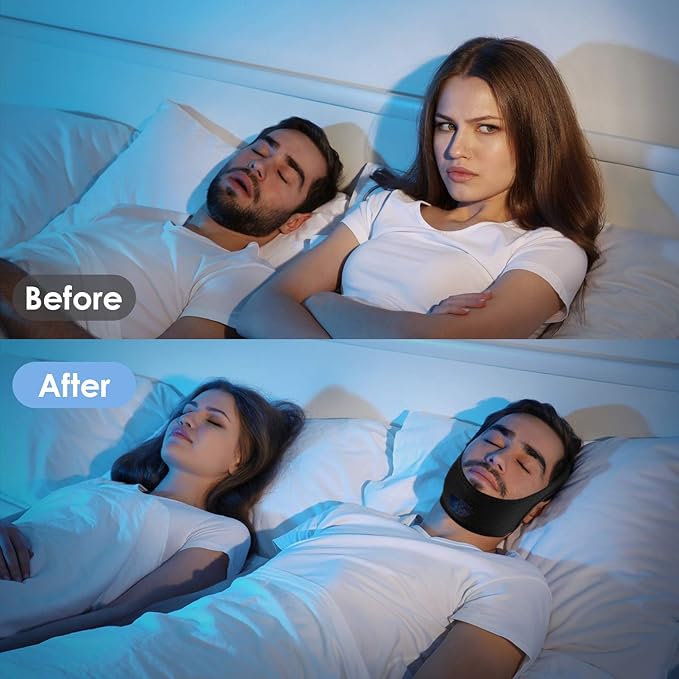 Chin Strap for Sleeping.Anti Snoring Chin Strap for CPAP Users,Adjustable and Breathable Chin Strap,Keep Mouth Closed for Effectively Reduce Snoring,Don't Fade,Skin Friendly Comfortable Sleeping