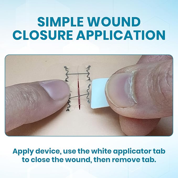 Emergency Wound Closures Surgical Quality Laceration Repair Without Stitches - Think Ahead - Be Prepared - Add to Your First Aid Kit, Camping Gear (Multi Pack - 3 Packs of 2 Medium Devices)