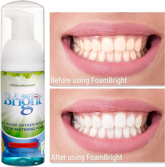 Retainer Foam Cleaner & Teeth Whitening Formula. The Ultimate Cleaning Toothpaste for Aligner Retainers. Great for All Kinds of Clear Retainers, Braces & Aligners. Safe for Dentures. (3 Pack)