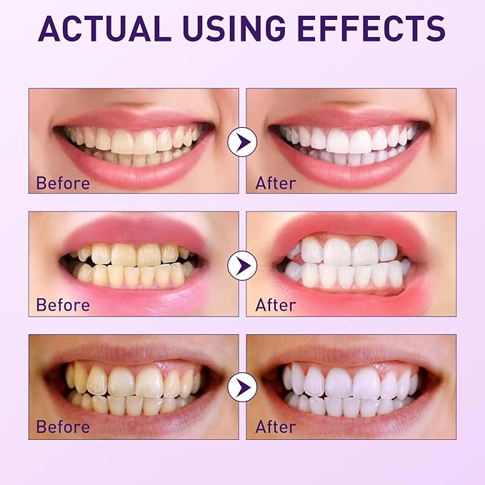 Purple Teeth Whitening Powder, Grape & Mint Flavor Natural Teeth Whitener, Color Corrector Toothpaste Powder for Tooth Stain Removal