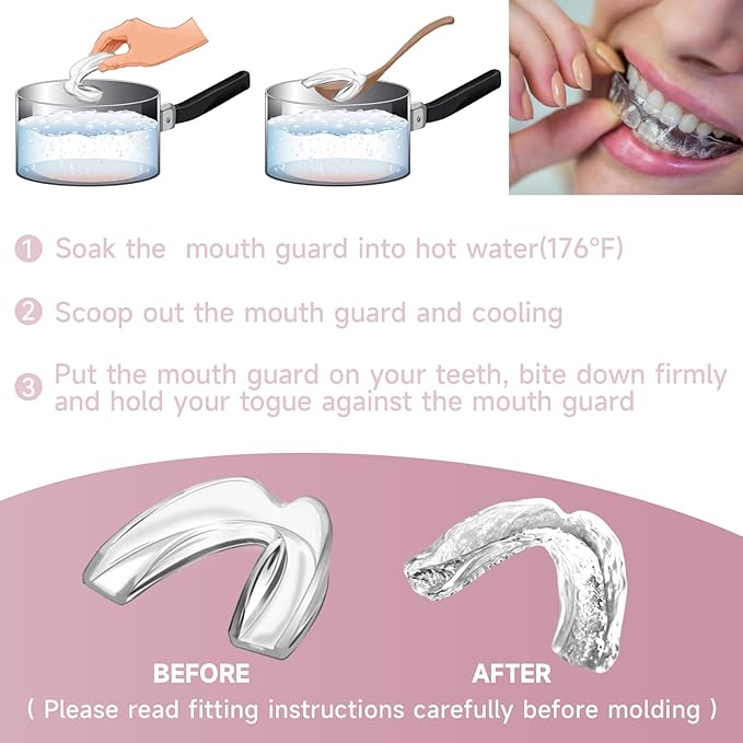 4 Pack Pink Mouth Guards for Women and Teens, Medium Size, Moldable Night Guards for Teeth Grinding and Clenching, Comfortable Bite Guards, Stylish Custom Dental Guards for Protection