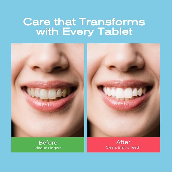Auranexa Whitening Toothpaste Tablets – Remineralizing Nano Hydroxyapatite Chewable Toothpaste with Xylitol & Probiotics, Gentle Fluoride-Free Clean, Fresh Lime Mint, 30 Tablets
