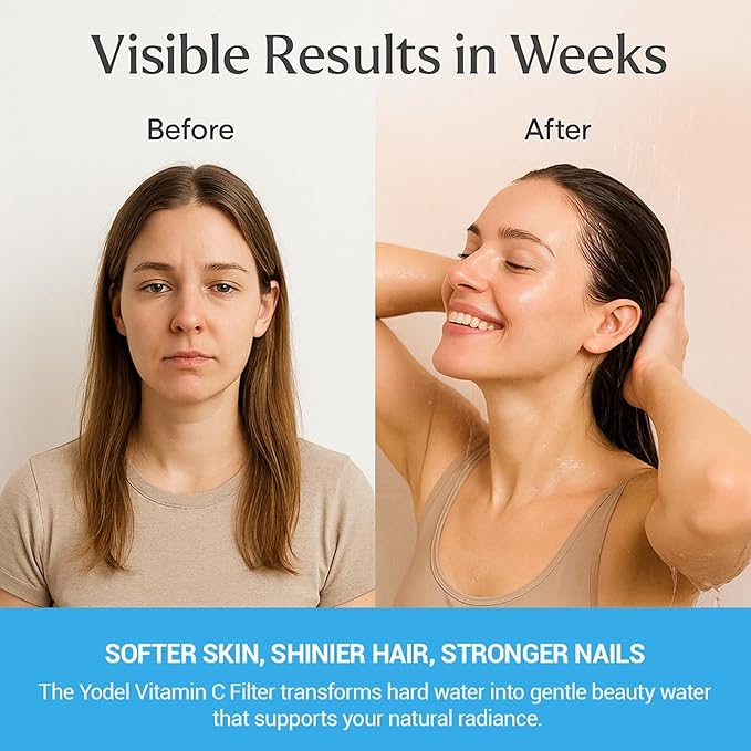 Yodel 25-Stage Vitamin C Shower Head Filter to Repair Damaged Hair,Skin and Nails, Prevent Scale Buildup,High Output Hard Water Softener 99% Remove Lead,Chlorine,Fluoride and Chemicals,Chrome