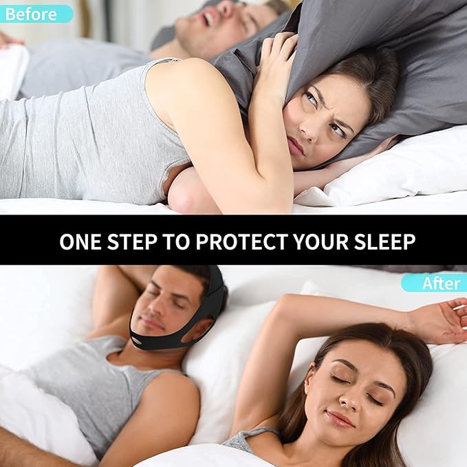 Anti Snoring Chin Strap for Men and Women, Comfortable Chin Strap for Cpap Users, Adjustable Stop Snoring Chin Strap Snoring Solution Chin Straps to Keep Mouth Closed While Sleeping (Black)