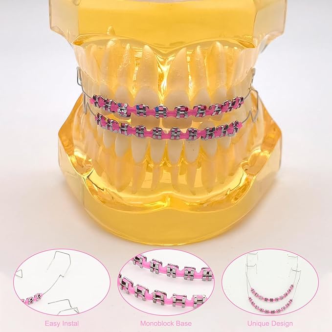 4 Pair of Temporary Tooth Decoration, Teeth Retainer Practical Brackets para Dientes Sturdy Retenedores de Dientes Ortodoncia Props for Dental Students to Practice (Pink)