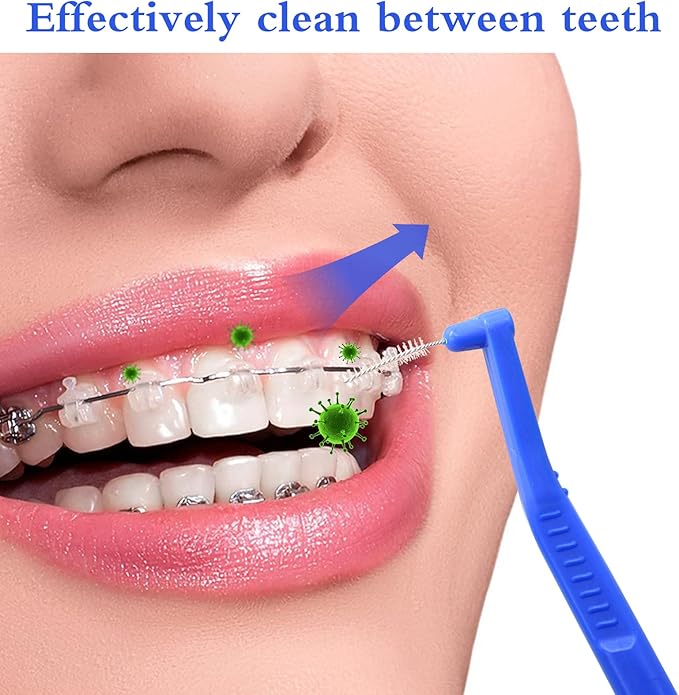 Angzhili 25 Pcs Interdental Angle Brushes,Reusable Dental Cleaners,Oral Dental Hygiene Brush,Dental Toothpick Floss for Braces,Tooth Cleaning Tool (Blue)