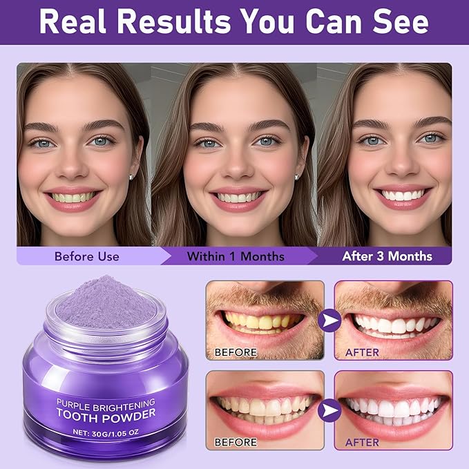 Teeth Whitening Powder,Purple Gentle Tooth Whitener,Safe & Gentle Formula,No Sensitivity,Daily Use, Enamel Friendly,Stain Removal, Color Corrector, and Toothpaste Booster (2 Pieces)