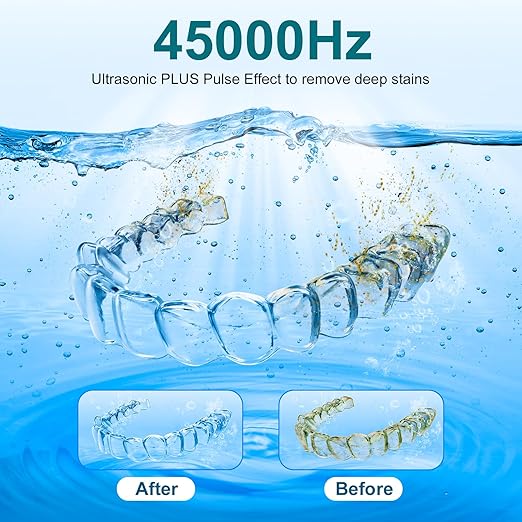 Ultrasonic Retainer Cleaner Machine, 200ML Ultrasonic Cleaning Pod with 4 Modes, Digital Timer for Denture Cleaner, Aligners, Mouth Guards, Braces, Jewelry & Toothbrush Heads